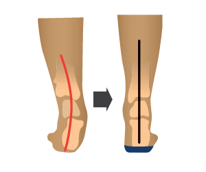 Archline Balance Full Length Orthotics