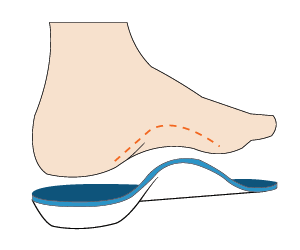 Archline Balance Full Length Orthotics